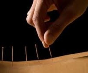What is Acupuncture